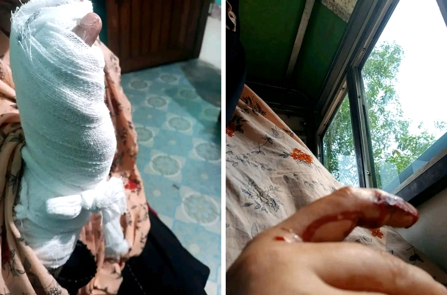 চুনারুঘাটে দুই নারীকে দেশীয় অস্ত্র দিয়ে ভাতিজার হামলা জমি দখলের চেষ্টা